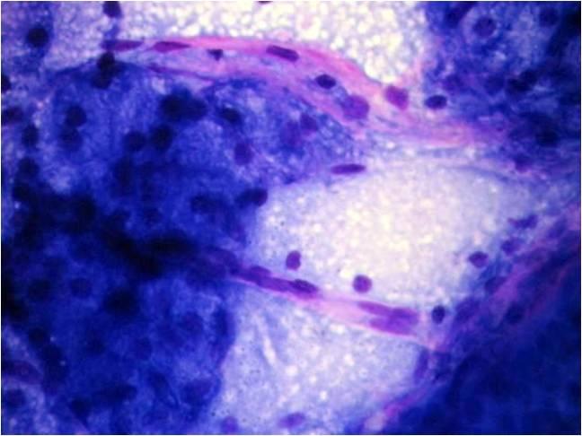 Anatomy And Cytology Of Salivary Glands Eurocytology