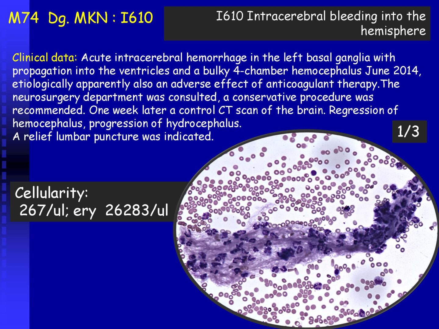 Cytology of the Cerebrospinal fluid - part II_Pagina_03