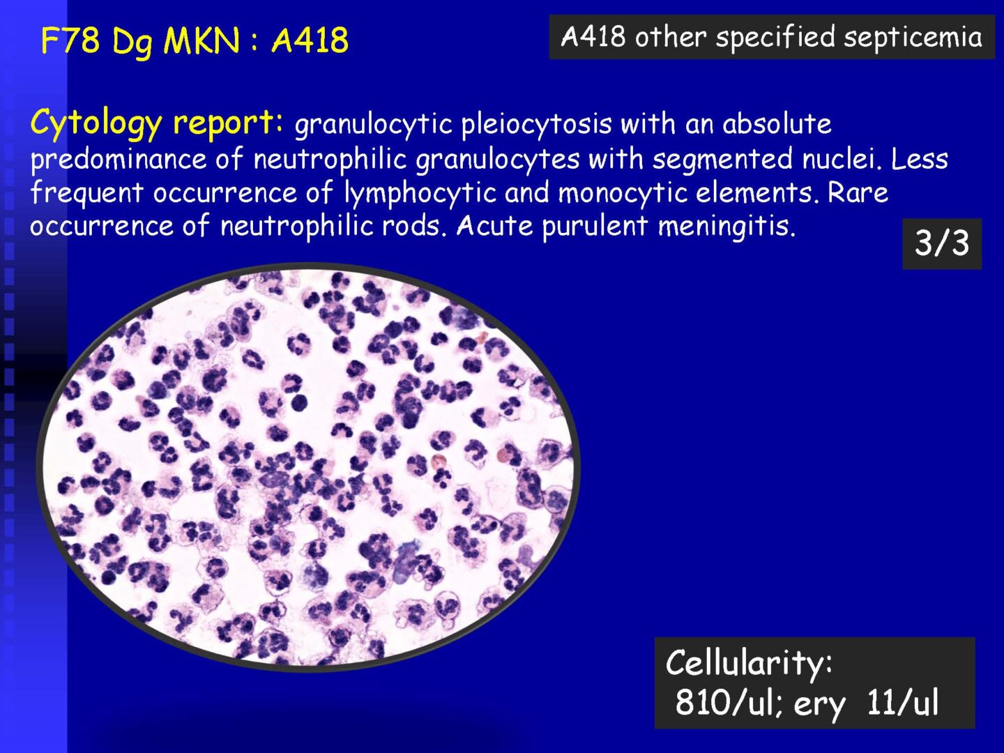 Cytology of the Cerebrospinal fluid - part II_Pagina_08