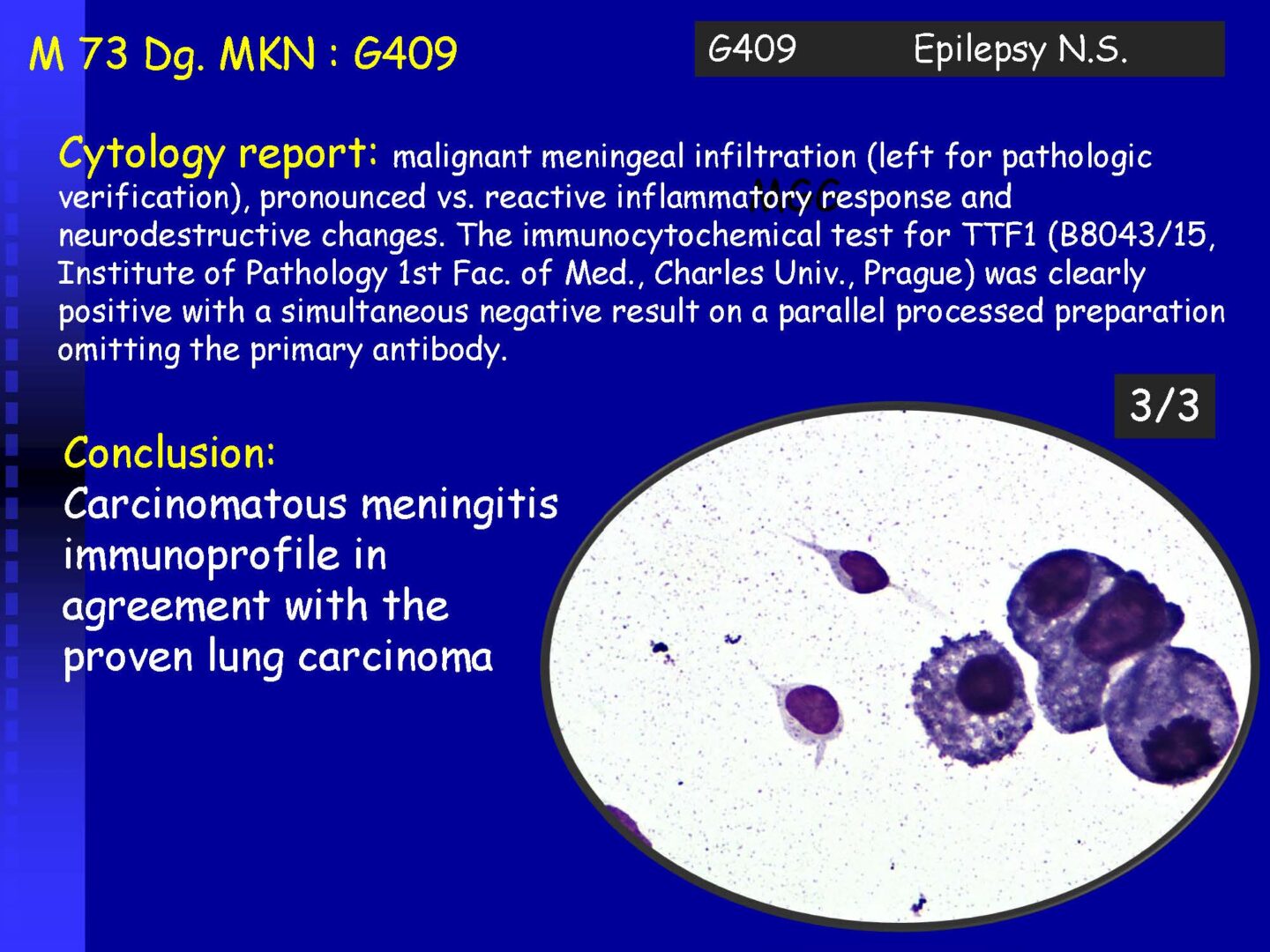 Cytology of the Cerebrospinal fluid - part II_Pagina_30