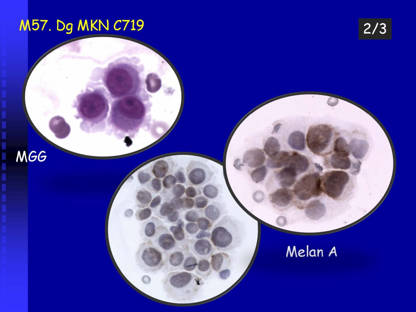 Cytology of the Cerebrospinal fluid - part II_Pagina_32