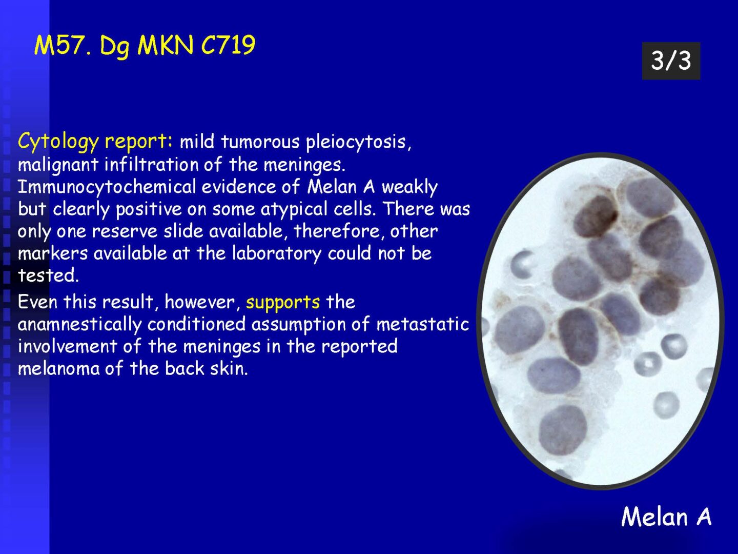 Cytology of the Cerebrospinal fluid - part II_Pagina_33