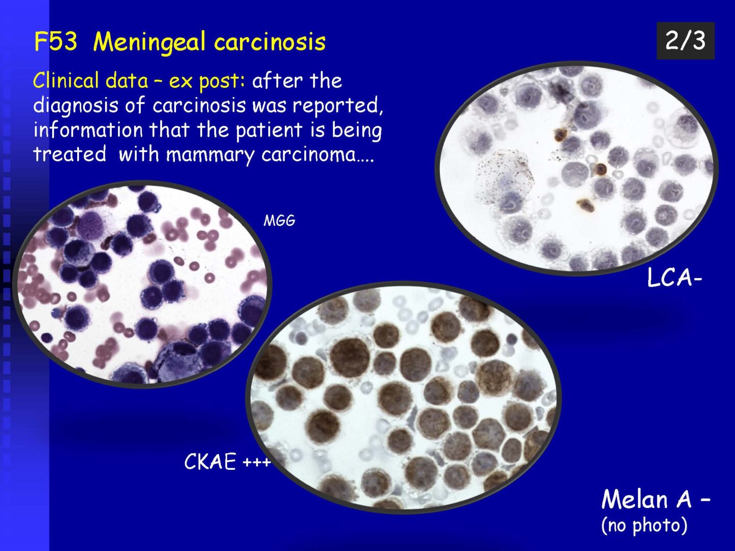 Cytology of the Cerebrospinal fluid - part II_Pagina_36