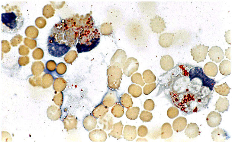 Fig. 7B_ORO