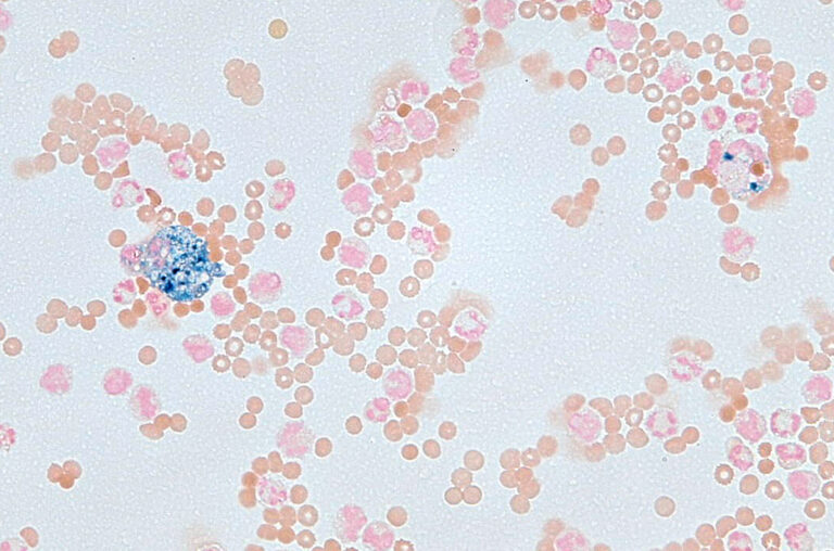 Fig. 8 Iron staining