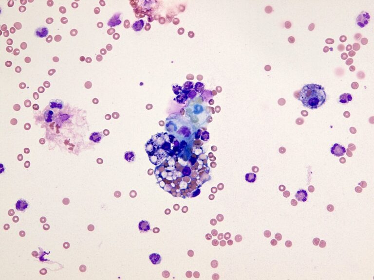 Fig. 6. MGG staining. Erythrocytes and macrophages with phagocytotic activity features (1)